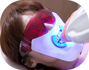 ホワイトニング施術の様子